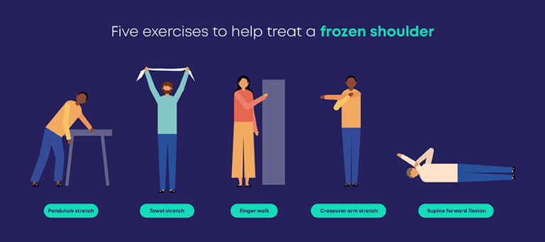 What Is A Frozen Shoulder Carl Todd Clinic