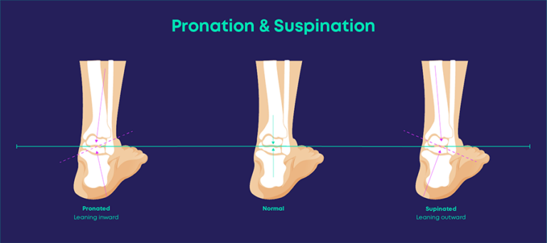 The Difference Between Supination And Pronation Carl Todd Clinic