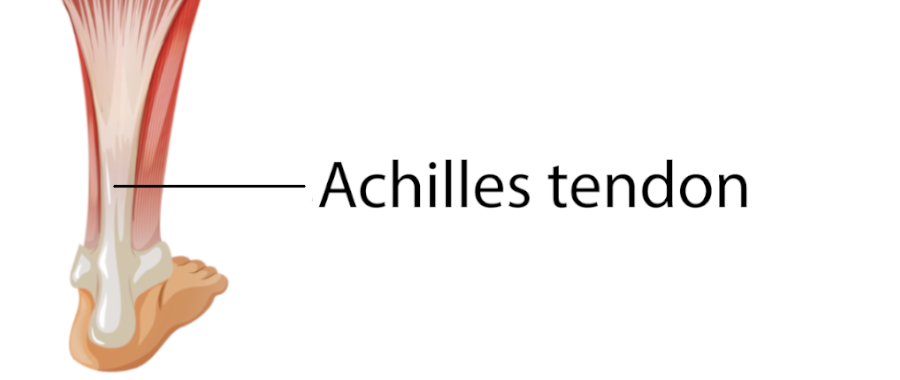 Graphic pointing out the Achillies tendon