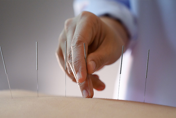 Acupuncture The Carl Todd Clinic