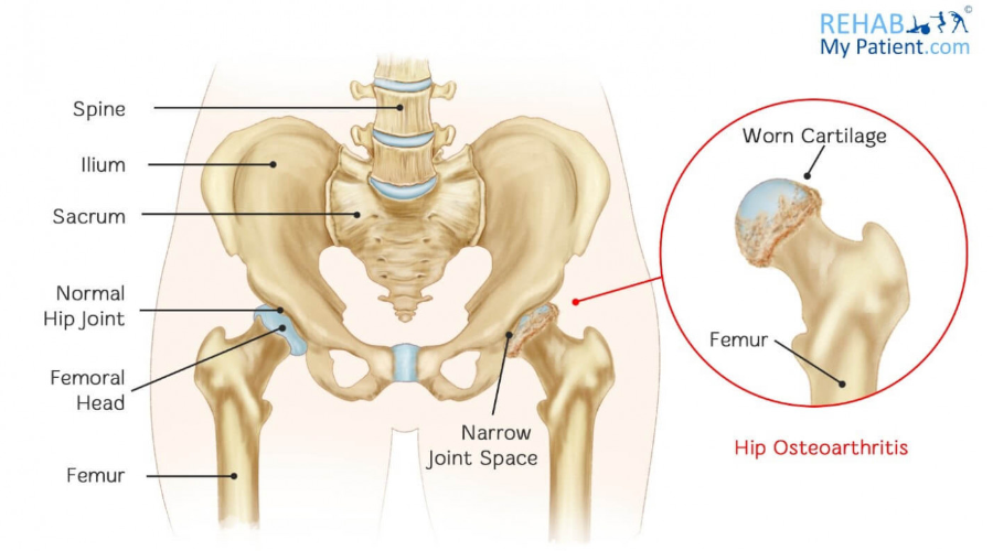 Hip diagram