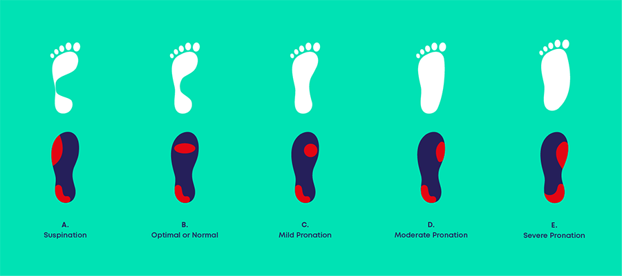 The difference between supination and pronation Carl Todd Clinic