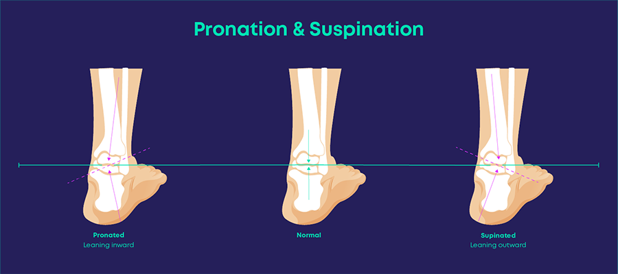 Foot 2024 supination correction