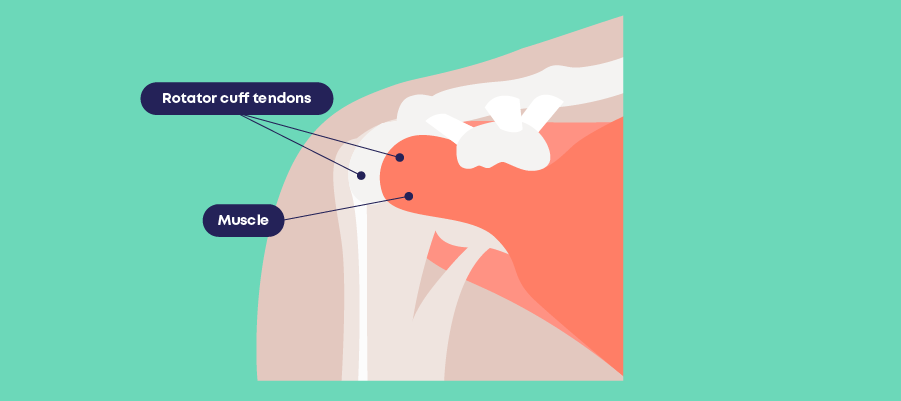 Diagram of Rotator Cuff