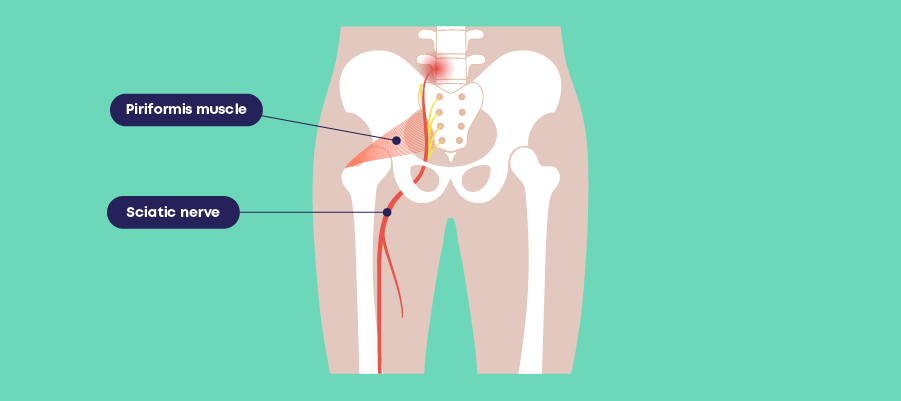 Diagram of the Piriformis muscle